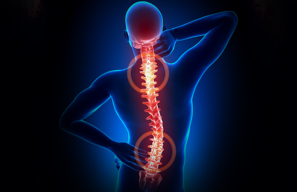 Stem Cell Therapy for Spinal Stenosis