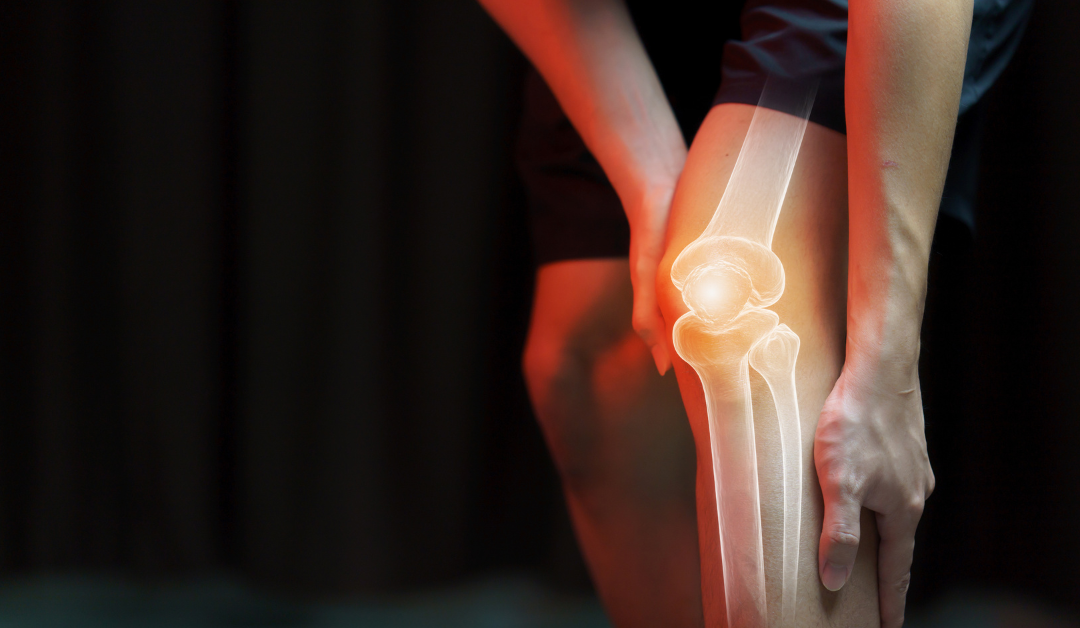Knee Instability Treatment Options