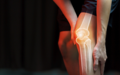 Unlocking Stability: The Ultimate Guide to Knee Instability Treatment Options