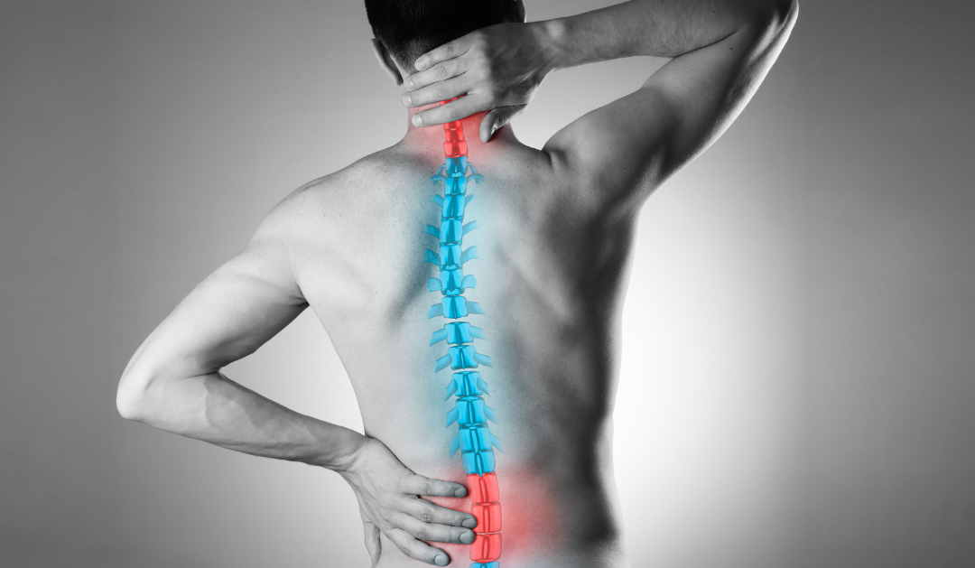 Spine Treatment without Surgery